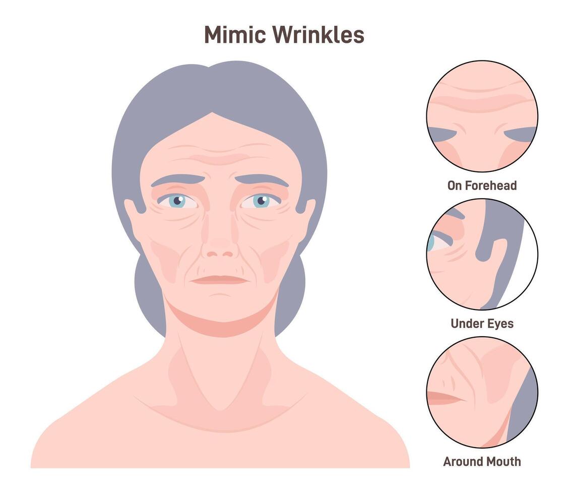 Mimic wrinkles. Age-related skin changes. Aging process, forehead vector
