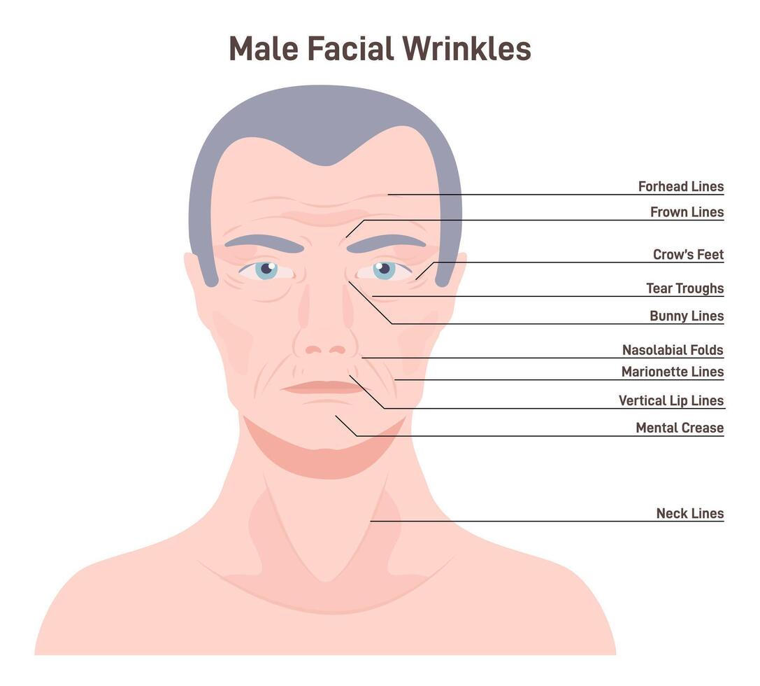 Mimic wrinkles. Age-related skin changes. Aging process, forehead vector