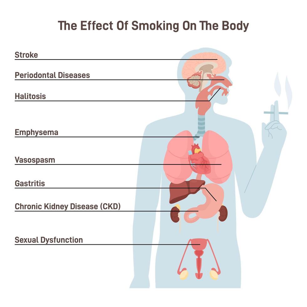 Diagram about health effect of cigarette smoking. Illustration about risk of smokers. vector