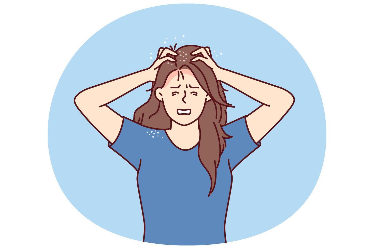 Woman suffers from itchy head after fungal infection and dandruff associated with bad hair shampoo vector