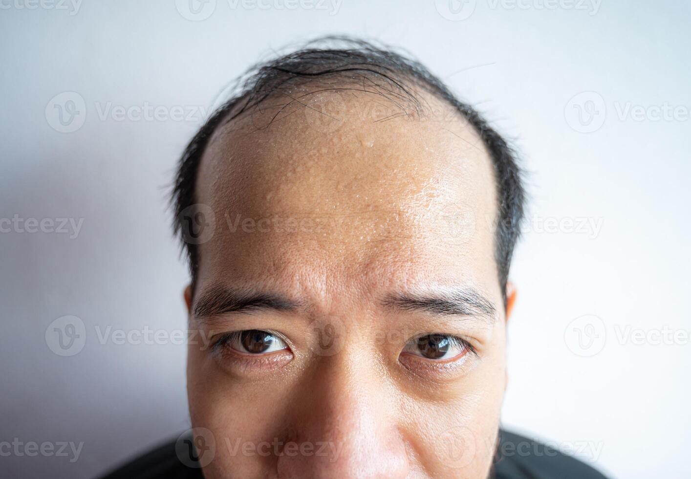 Cropped shot view of Asian man with sweating on his forehead cause of hot weather or etc. Sweat is actually the body's built-in cooling system when your body temperature rises. photo