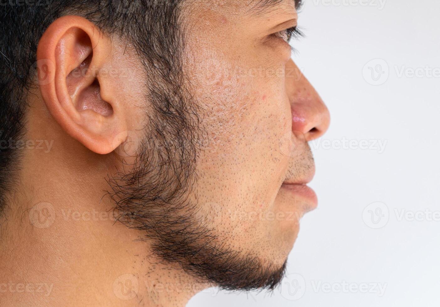 Side view of Asian man face with beard grows on a part of his face. Beard is the collection of hair that grows on the chin, upper lip, cheeks and neck of humans. photo