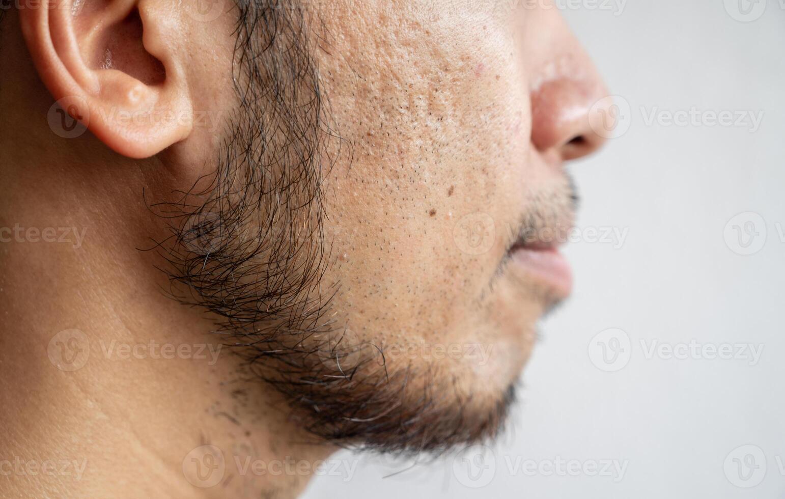 Side view of Asian man face with beard grows on a part of lower face. Beard is the collection of hair that grows on the chin, upper lip, cheeks and neck of humans. photo