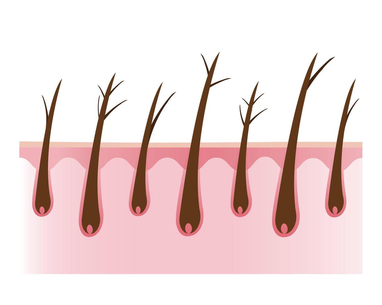 The cross section of damaged and types of split ends hair with scalp layer illustration isolated on white background. Dryness, baby split, y split and tree. Hair care and problem concept. vector