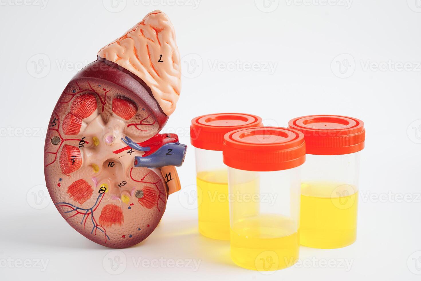 Urinalysis, Kidney and urine cup for check health examination in laboratory. photo