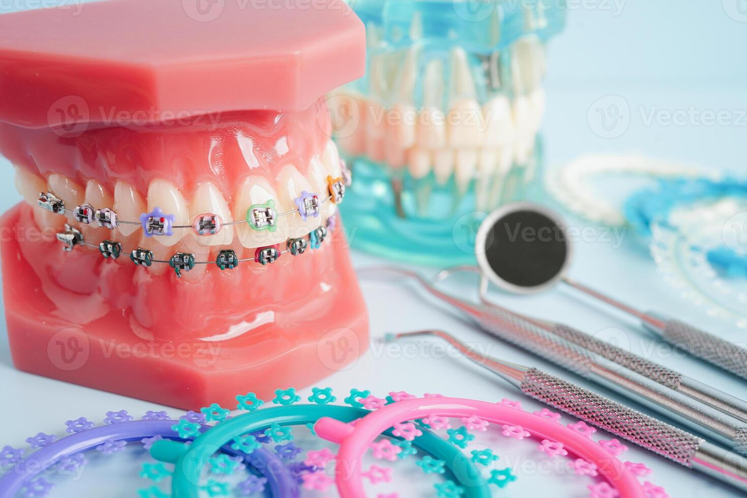 Orthodontic ligatures rings and ties, elastic rubber bands on orthodontic braces, model for dentist studying about dentistry. photo