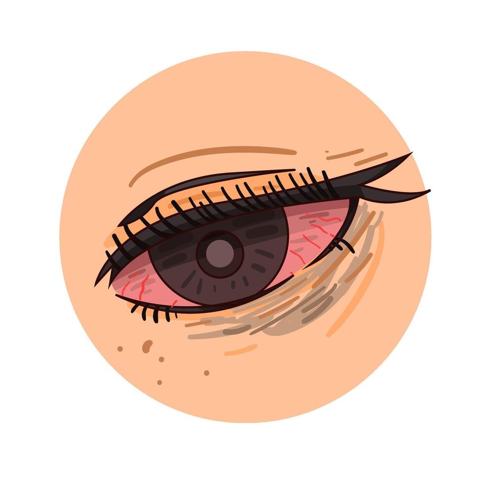 Illustration of red eye vector