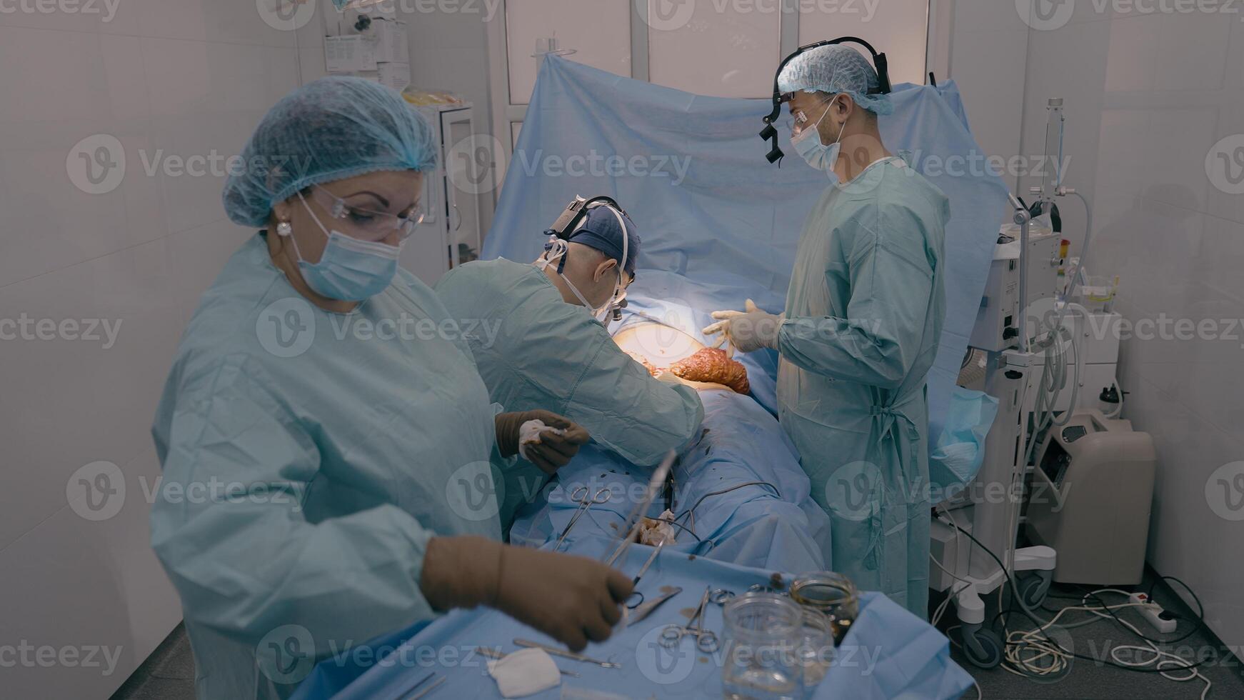 Surgery team professional doctors surgeons perform surgical operation stomach laparoscopy medical equipment nurse assistant give sterile instruments patient health treatment in operating room hospital photo