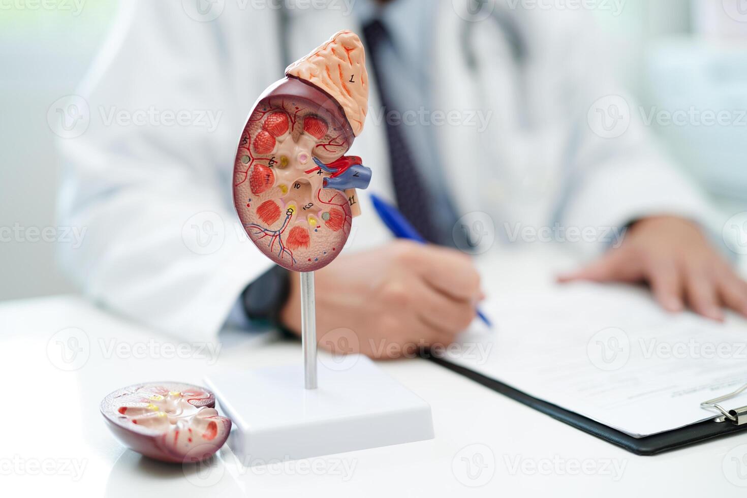 Chronic kidney disease, doctor with model for treatment urinary system, urology, Estimated glomerular filtration rate eGFR. photo
