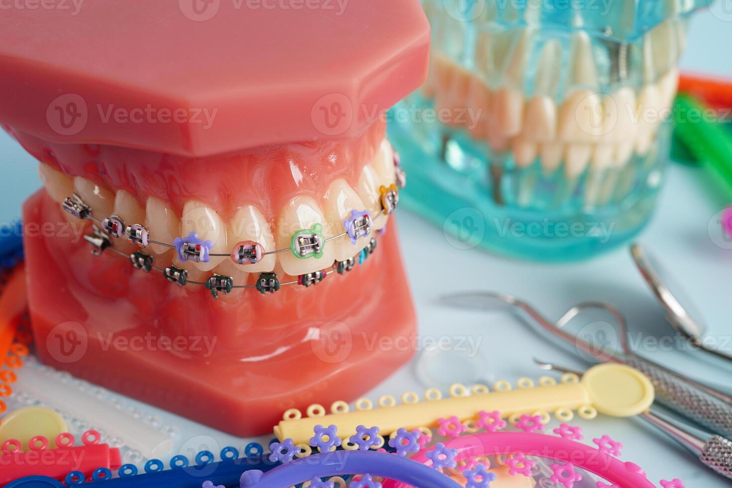 Orthodontic ligatures rings and ties, elastic rubber bands on orthodontic braces, model for dentist studying about dentistry. photo