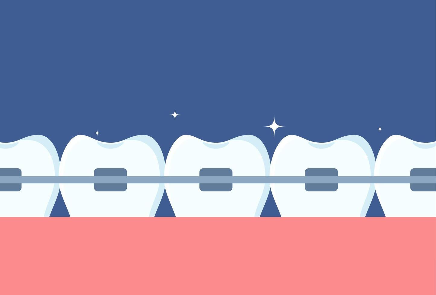 Row of teeth with braces on them. Orthodontics and aesthetic dentistry medicine. Molars with braces. Dentistry, whitening, orthodontics. . vector