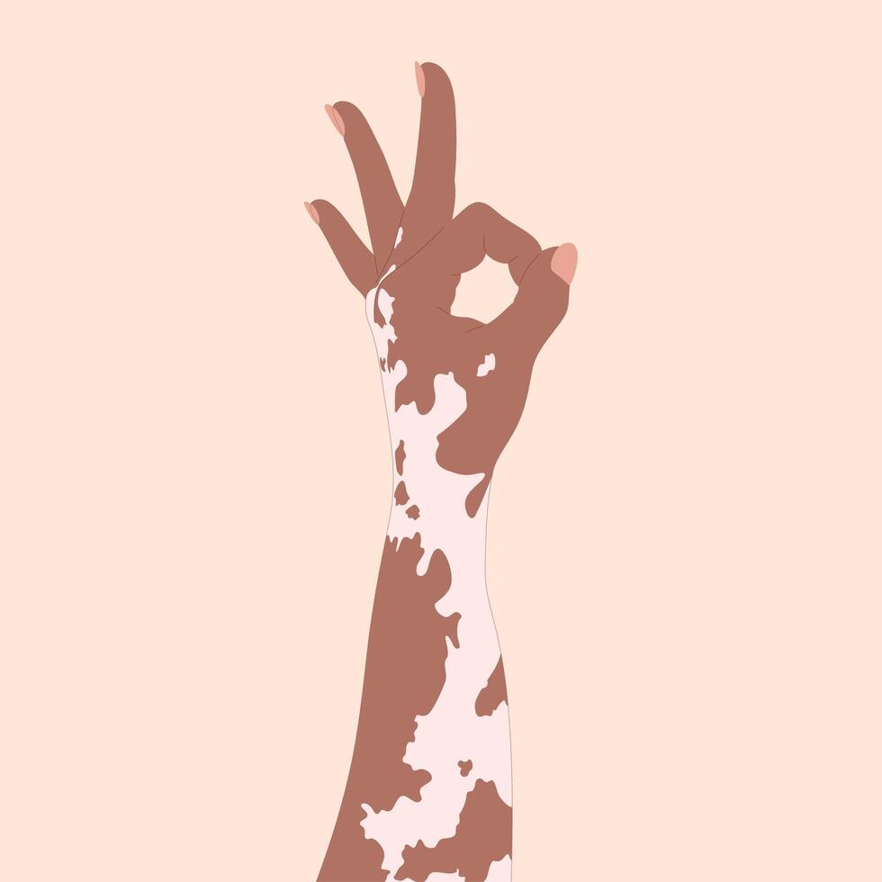 African-American female hand with vitiligo showing the okay sign vector