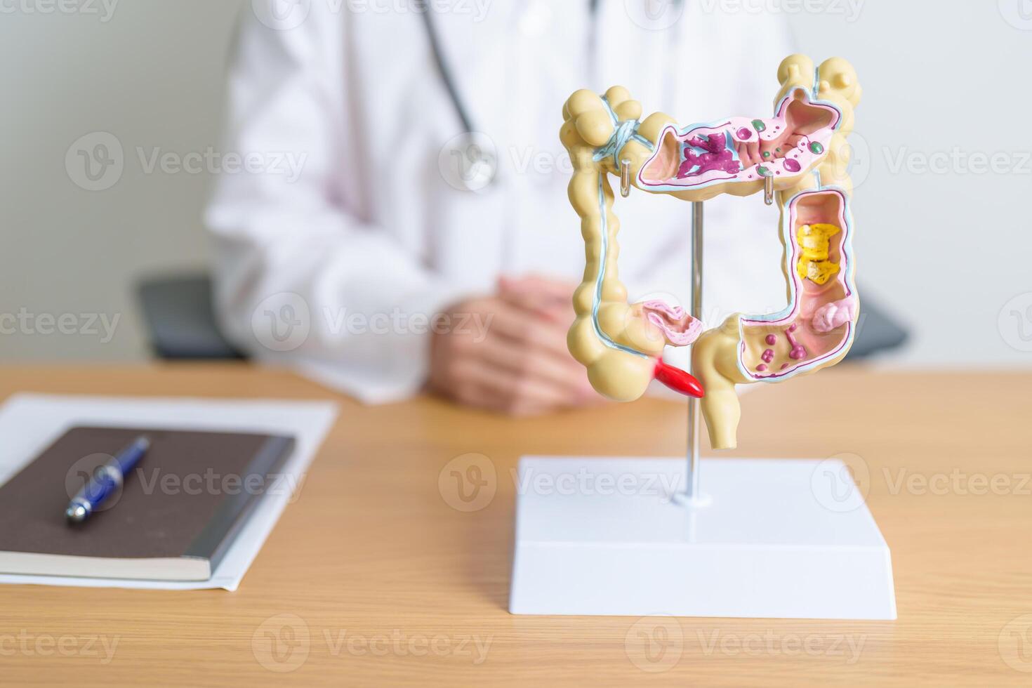 Doctor with human Colon anatomy model. Colonic disease, Large Intestine, Colorectal cancer, Ulcerative colitis, Diverticulitis, Irritable bowel syndrome, Digestive system and Health concept photo