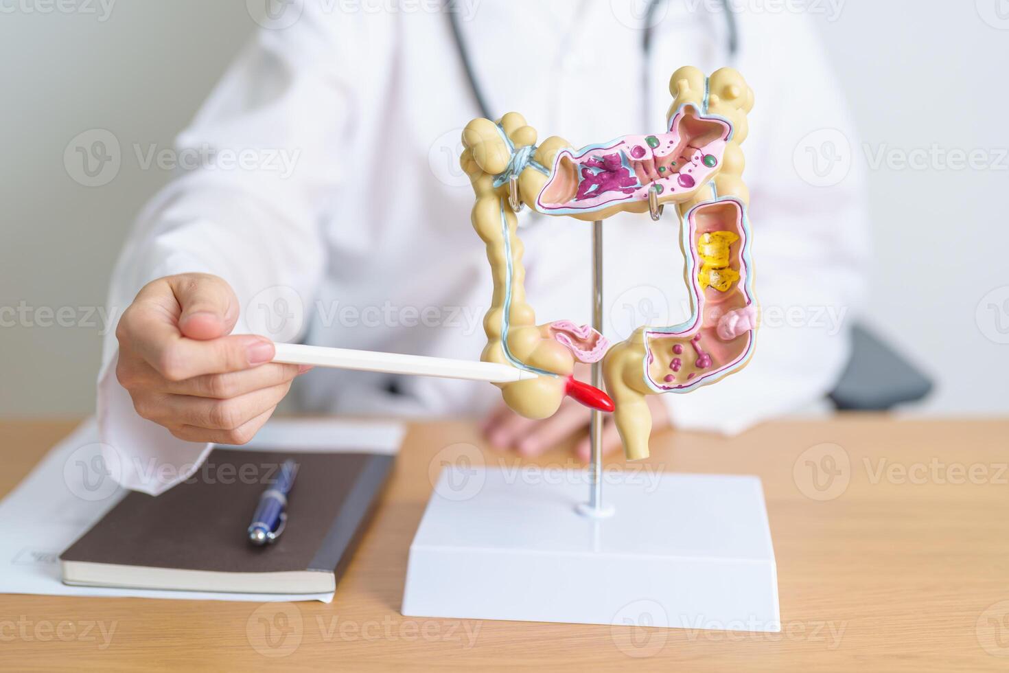 Doctor with human Colon anatomy model. Colonic disease, Large Intestine, Colorectal cancer, Ulcerative colitis, Diverticulitis, Irritable bowel syndrome, Digestive system and Health concept photo