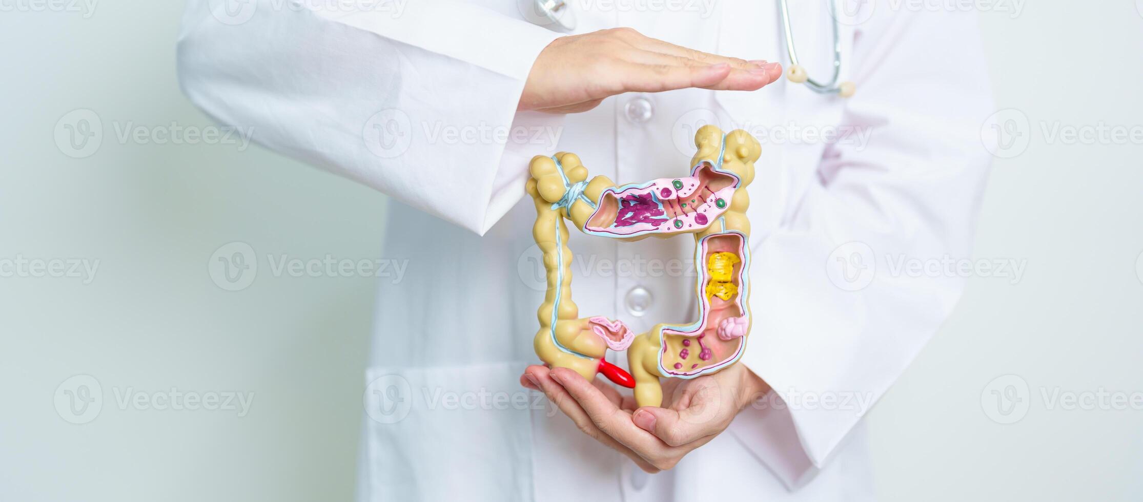 Doctor with human Colon anatomy model. Colonic disease, Large Intestine, Colorectal cancer, Ulcerative colitis, Diverticulitis, Irritable bowel syndrome, Digestive system and Health concept photo