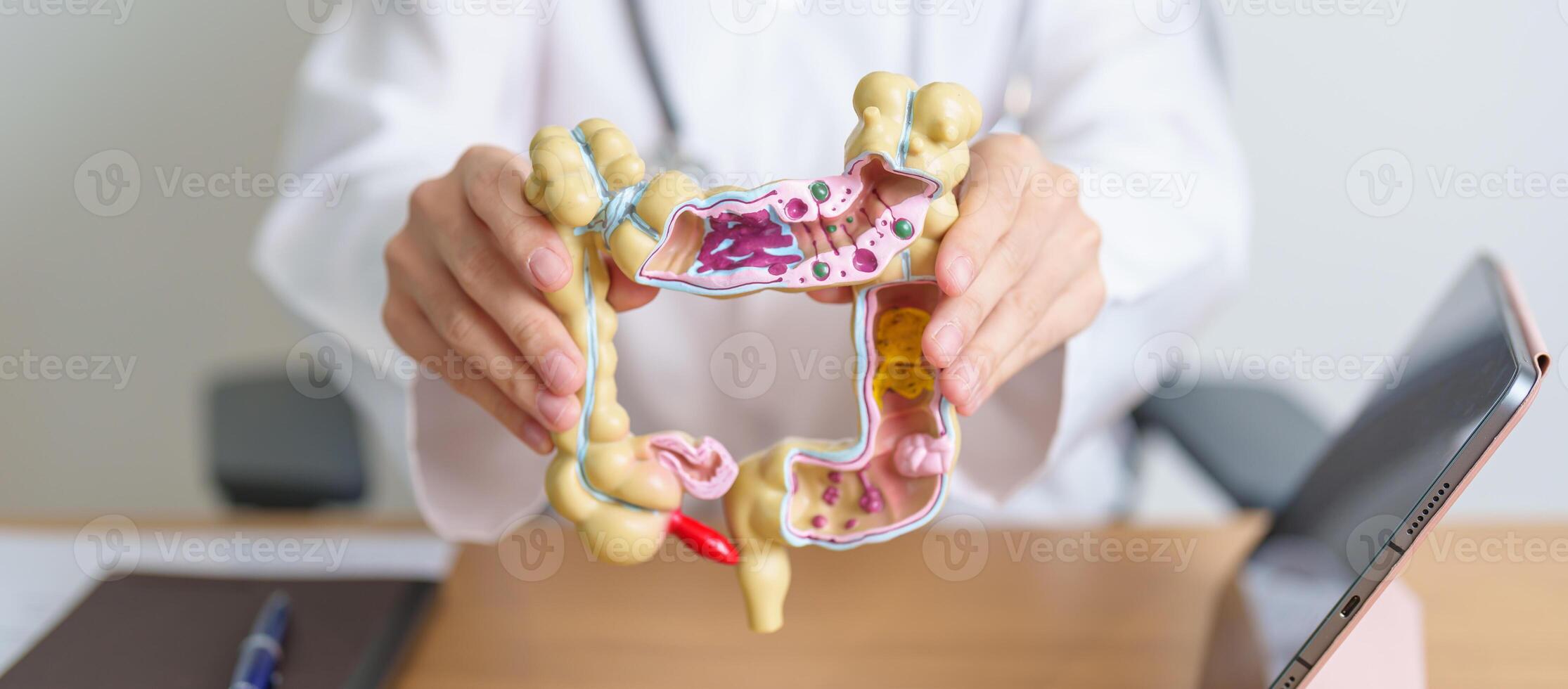 Doctor with human Colon anatomy model and tablet. Colonic disease, Large Intestine, Colorectal cancer, Ulcerative colitis, Diverticulitis, Irritable bowel syndrome and Digestive system photo