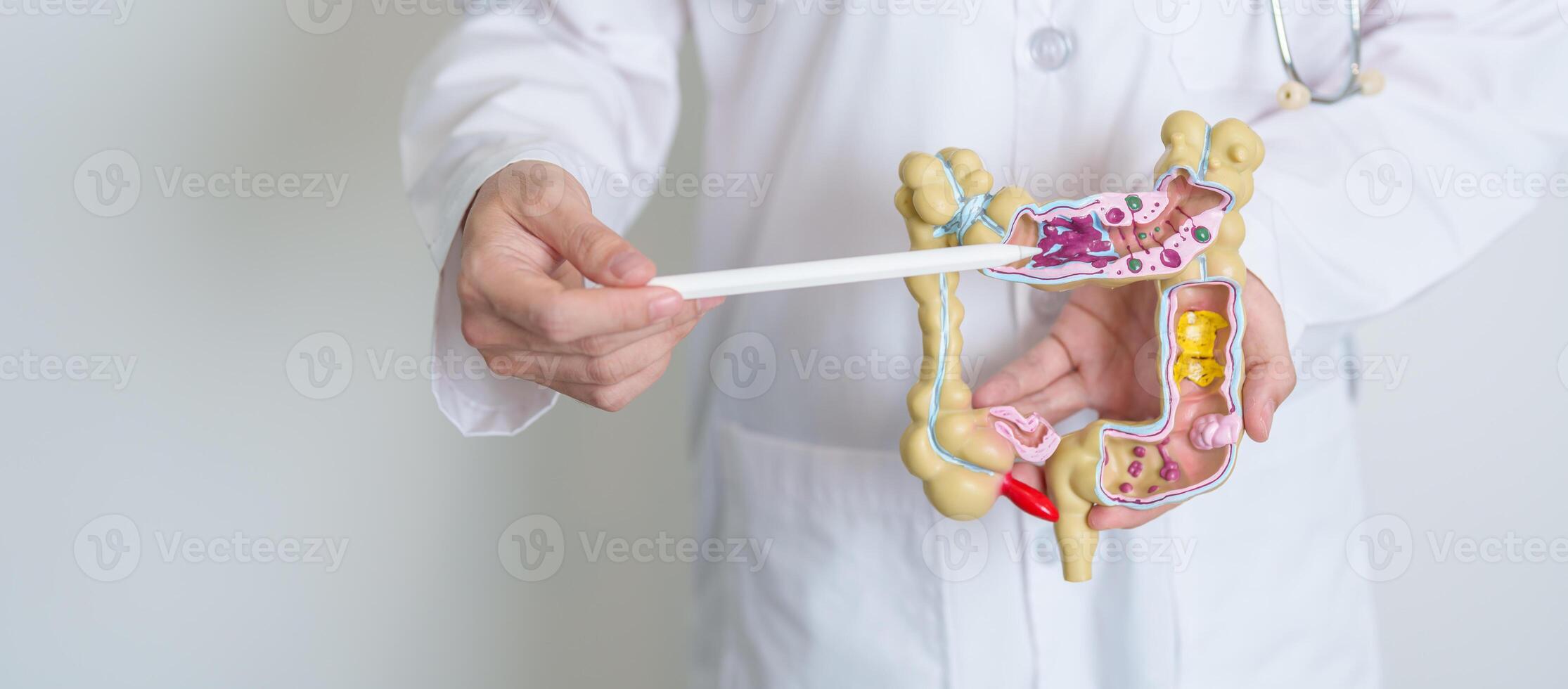 Doctor holding human Colon anatomy model. Colonic disease, Large Intestine, Colorectal cancer, Ulcerative colitis, Diverticulitis, Irritable bowel syndrome, Digestive system and Health concept photo