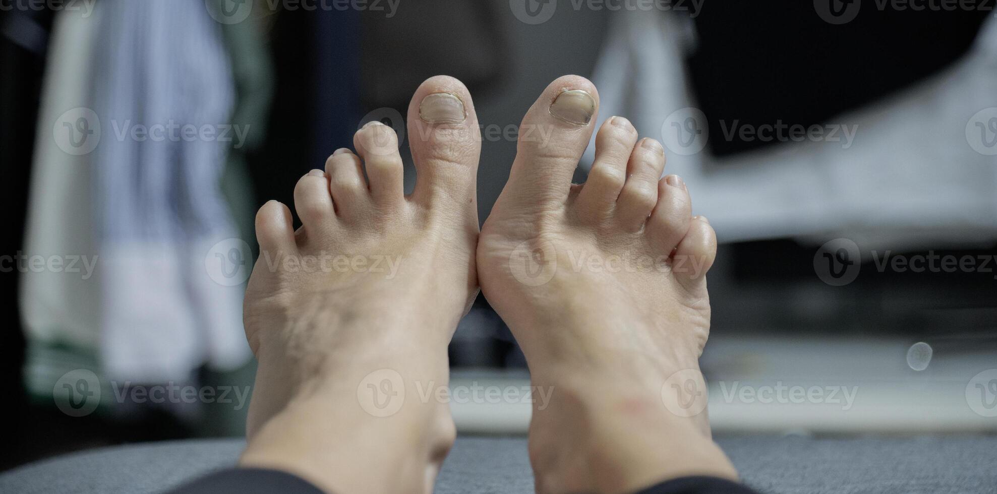el pie son en no el mejor condición, pedicure es requerido foto