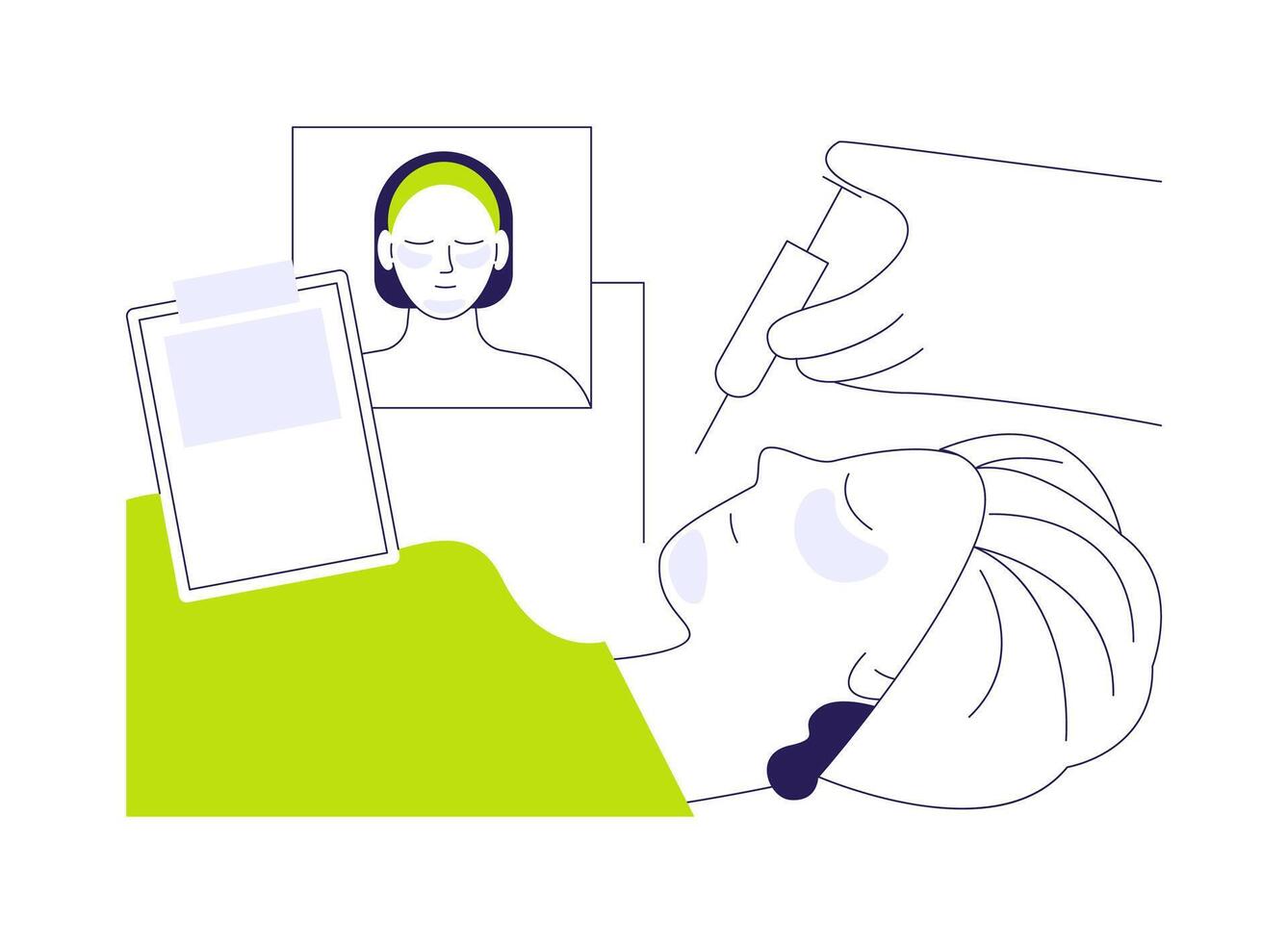 Facial implants abstract concept illustration. vector