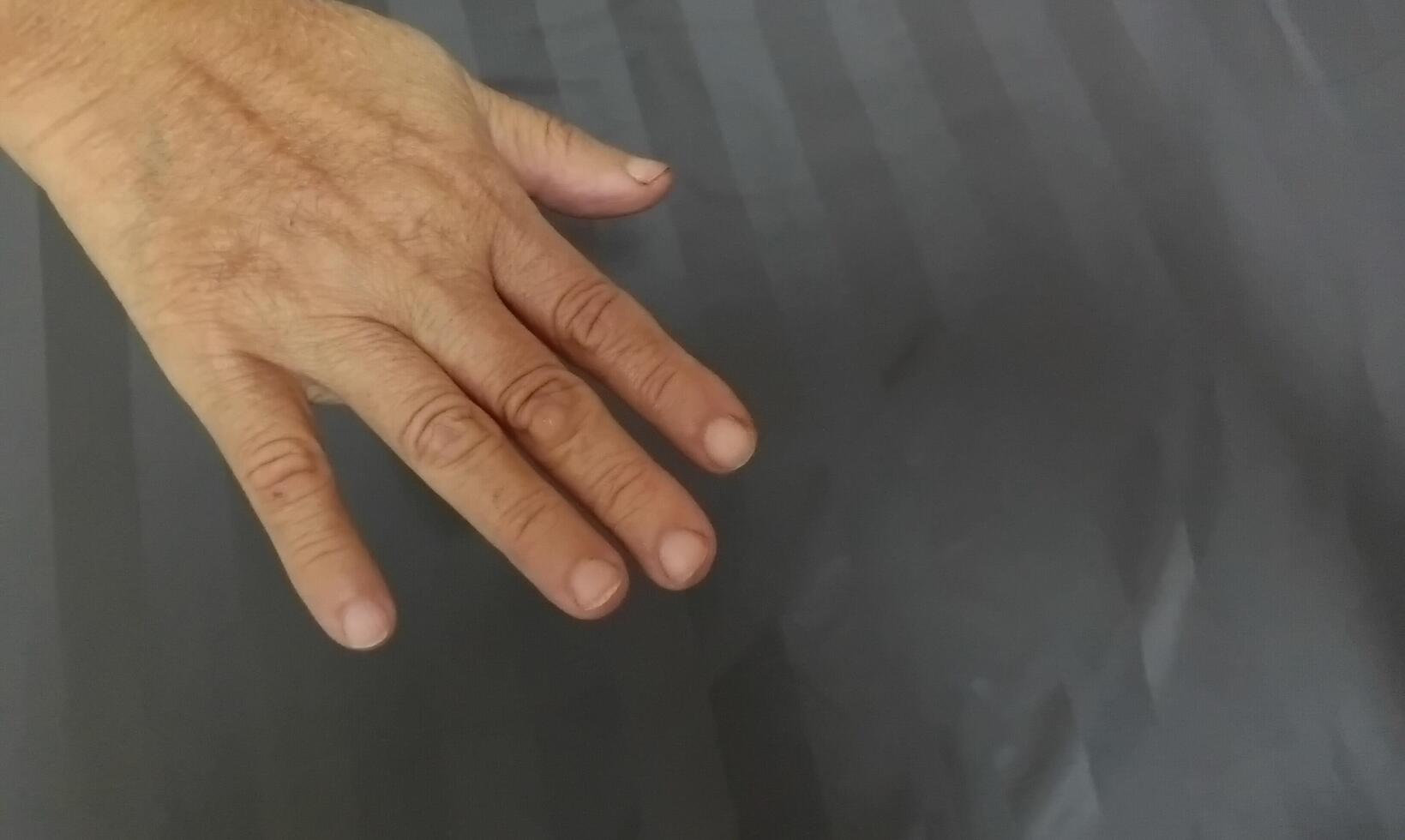The hand has 5 fingers. photo