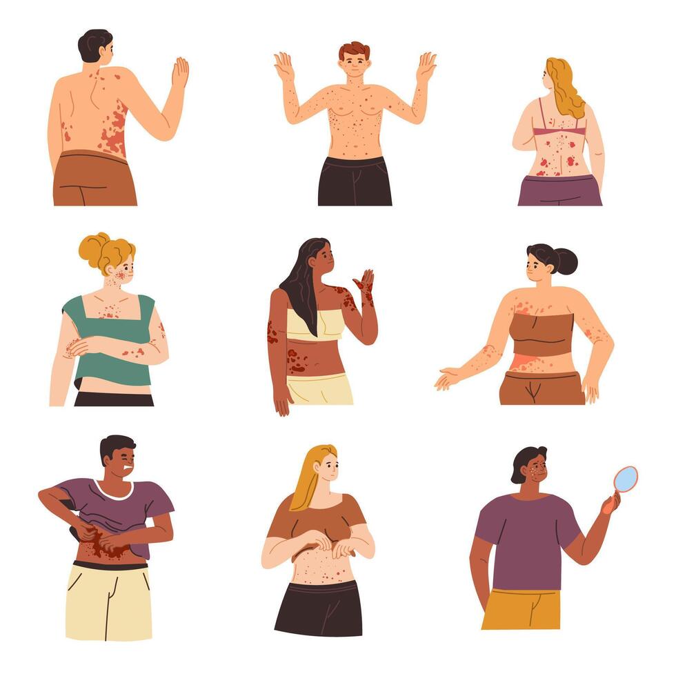 People with Skin Rash Set vector