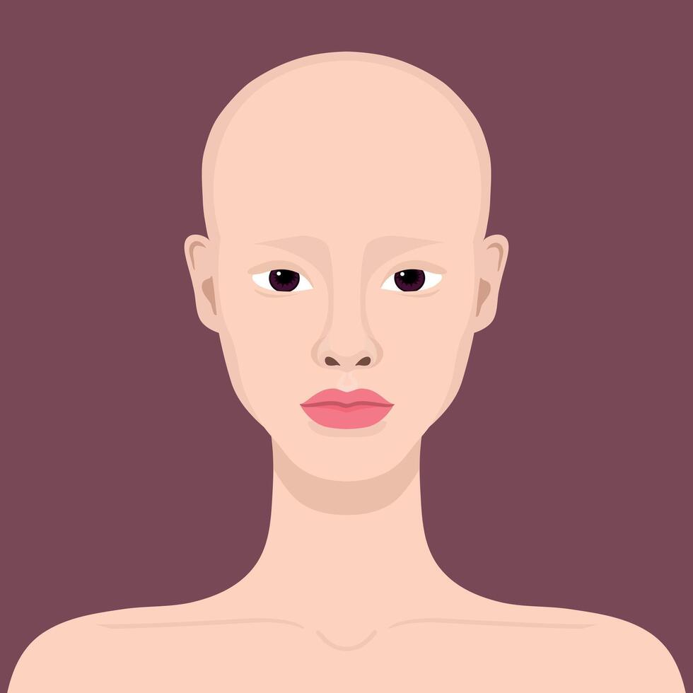 Young woman with alopecia. Beautiful bald girl. Alopecia areata. illustration vector