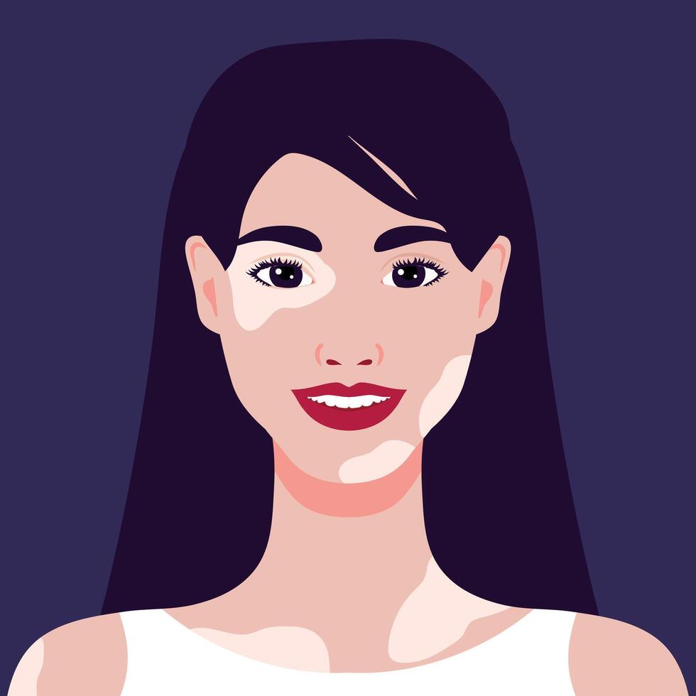 Beautiful smiling young woman with vitiligo depigmentation. Rare appearance. Portrait or an avatar. illustration vector