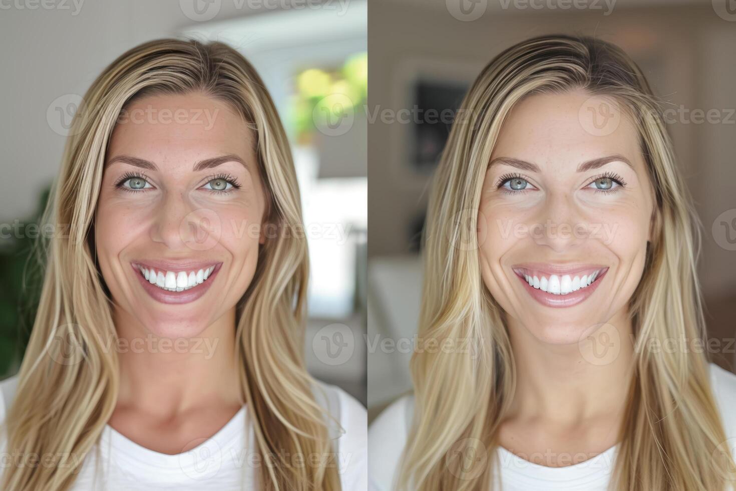 Smile Enhancement Comparison photo