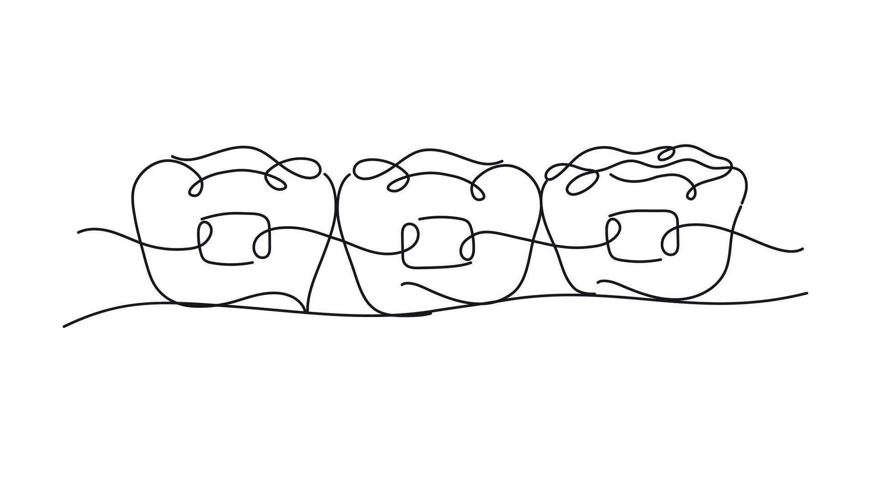 Teeth braces illustration drawing in flat line style on white color background vector