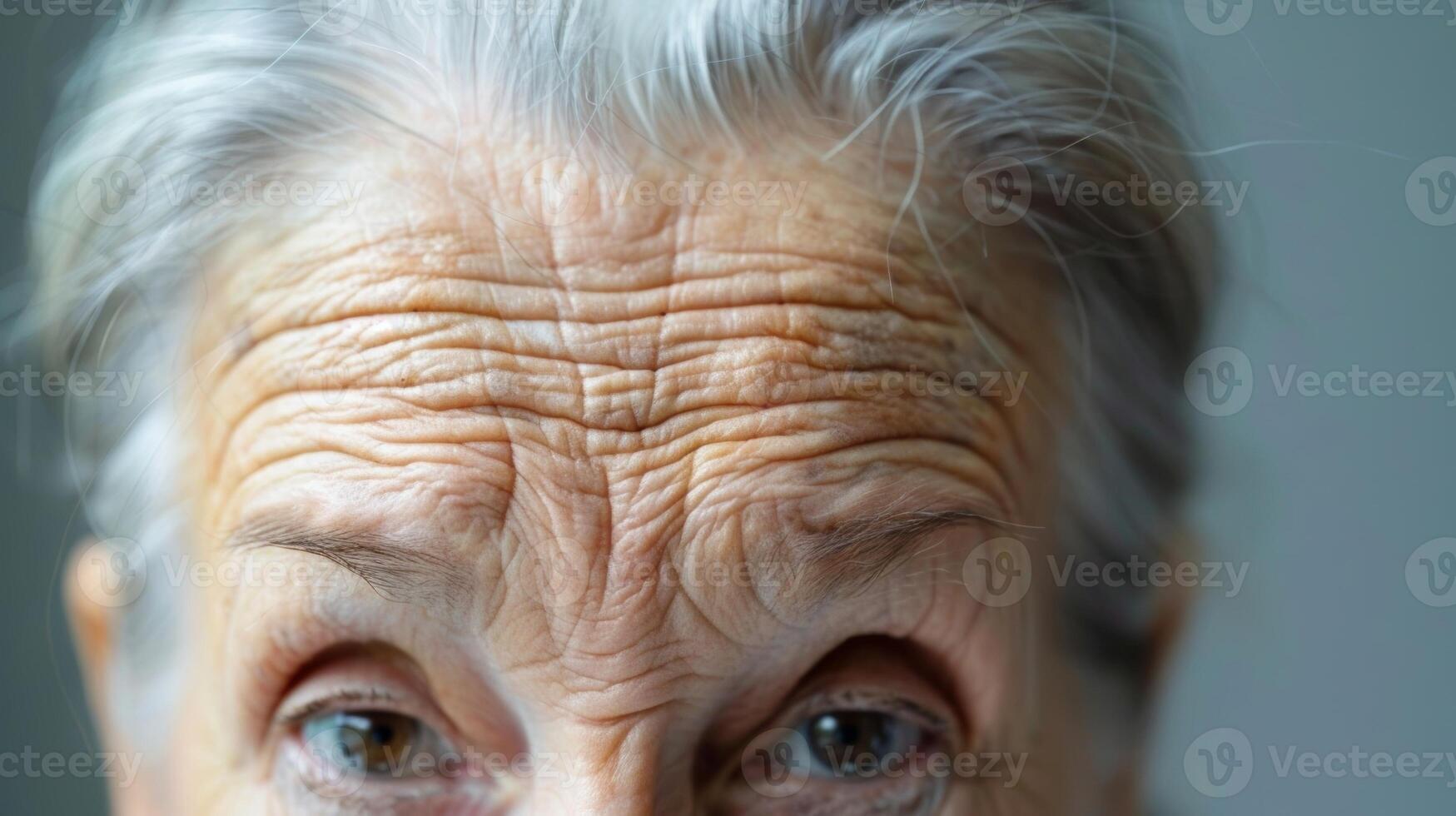 A closeup of a persons forehead with multiple lines and wrinkles showcasing the toll that memory loss can take on a person photo