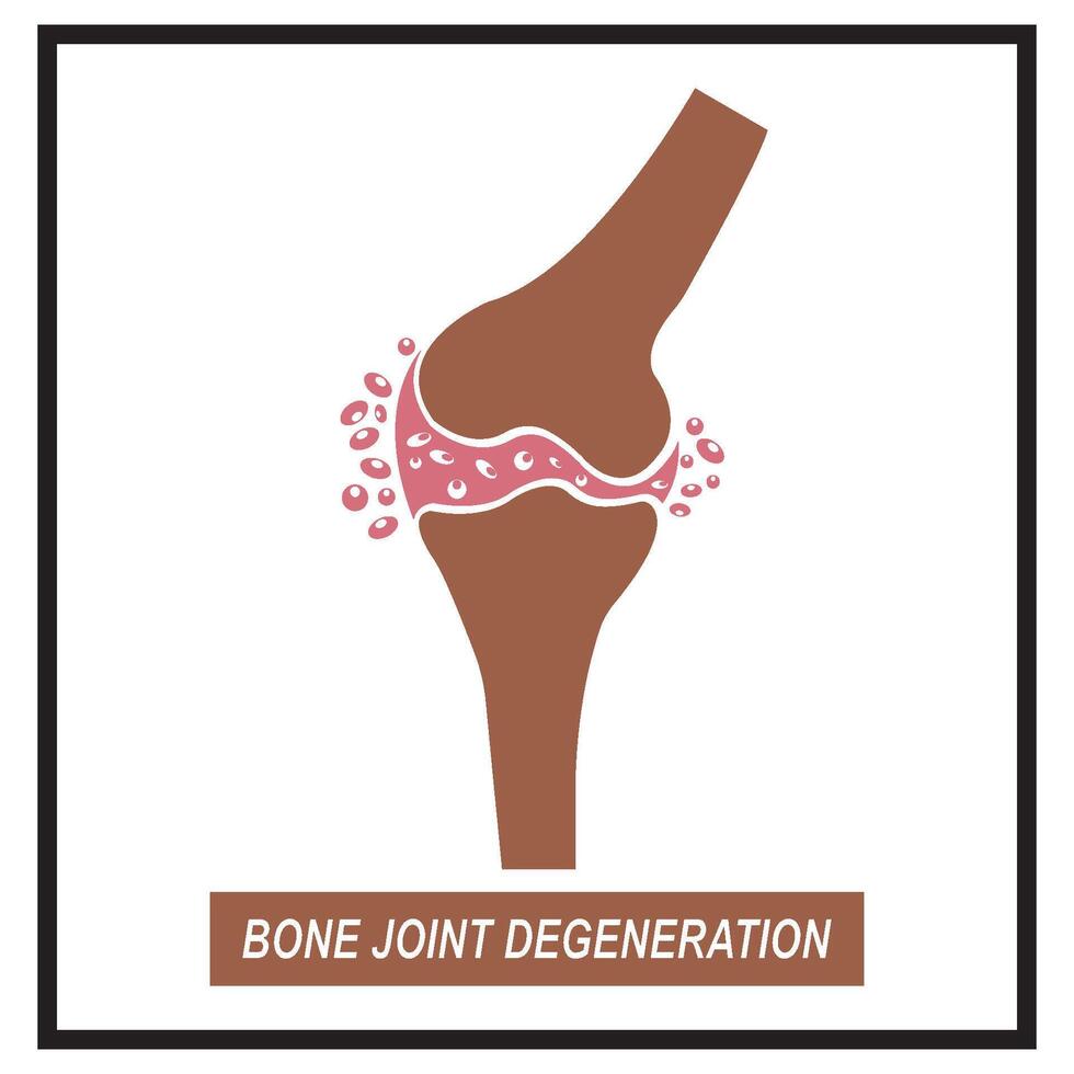 Bone joint degeneration icon vector