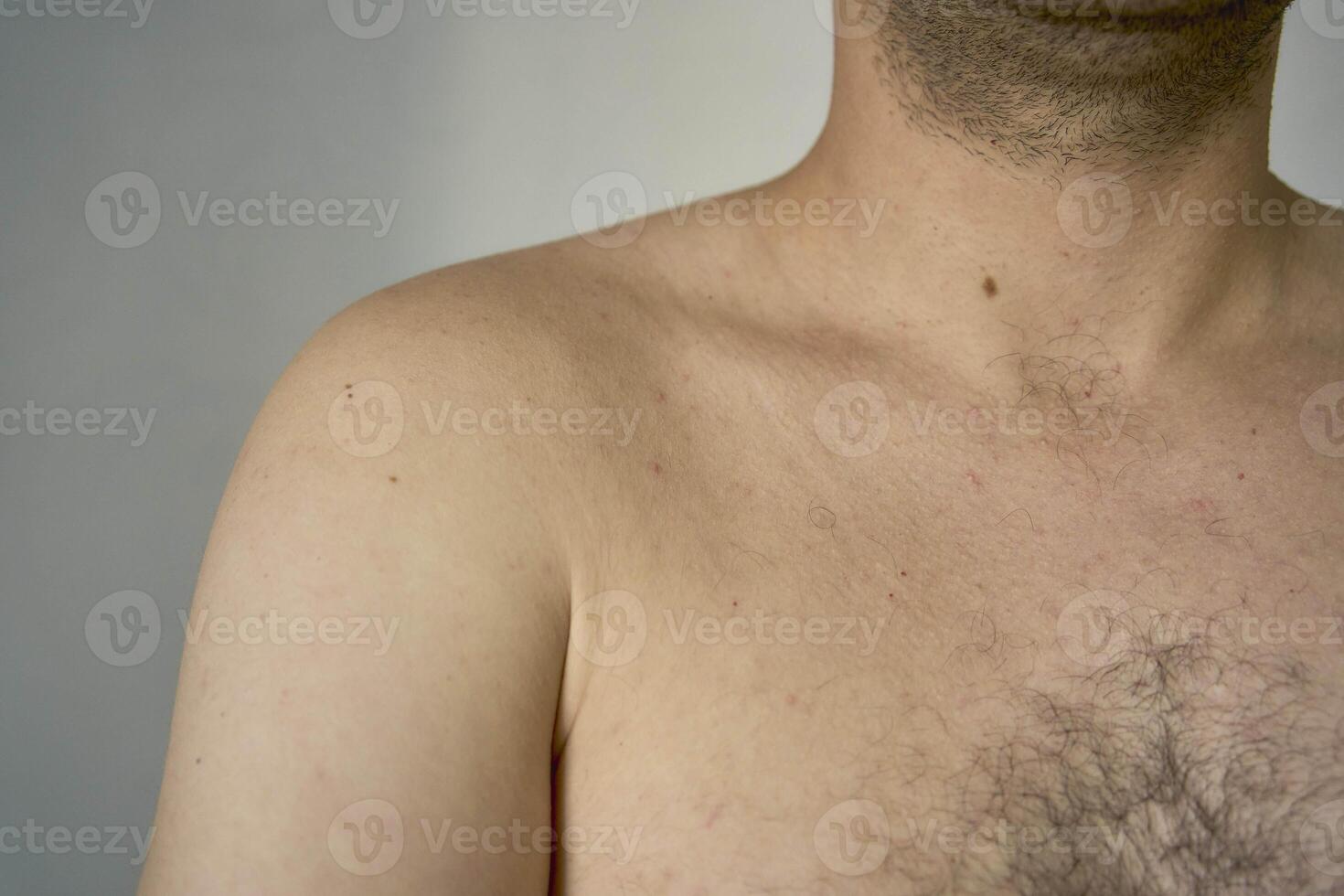 shoulder of a thirty-year-old man of medium build photo