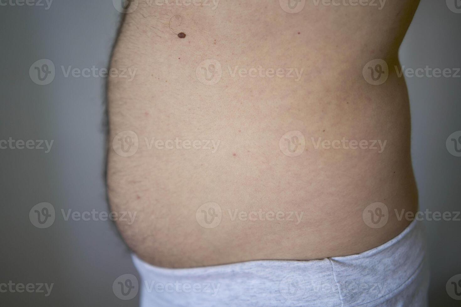 the side and stomach of a thirty-year-old man of average build photo