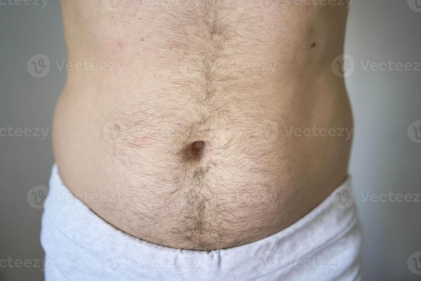 the side and stomach of a thirty-year-old man of average build photo