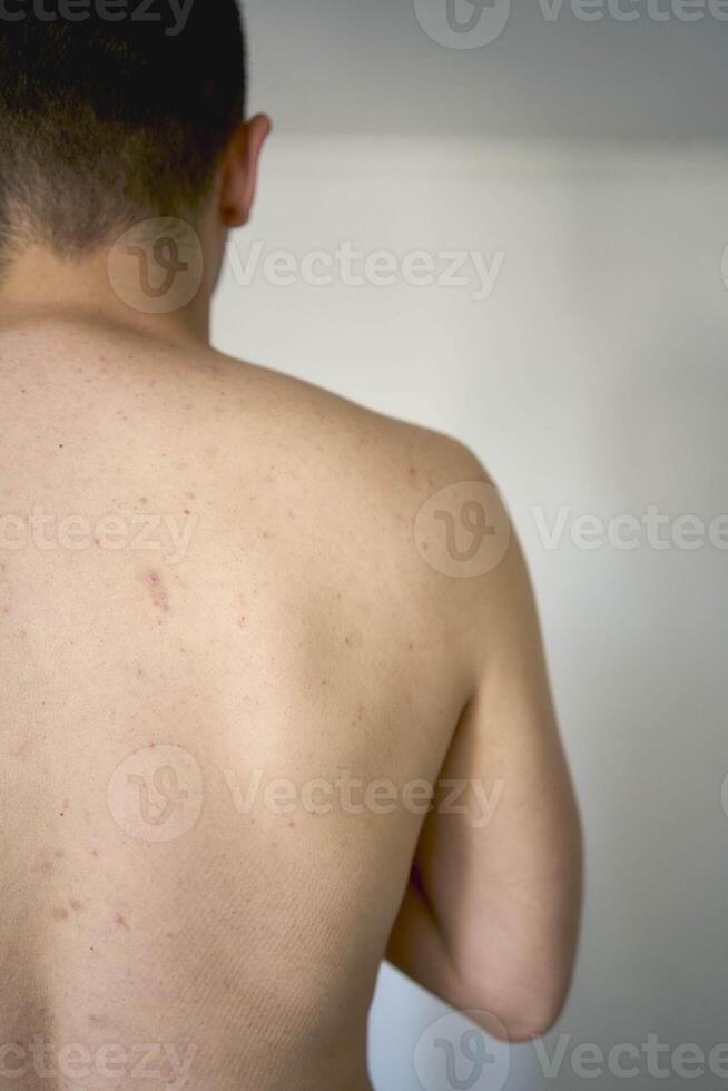 back and lower back of a thirty year old man of medium build photo