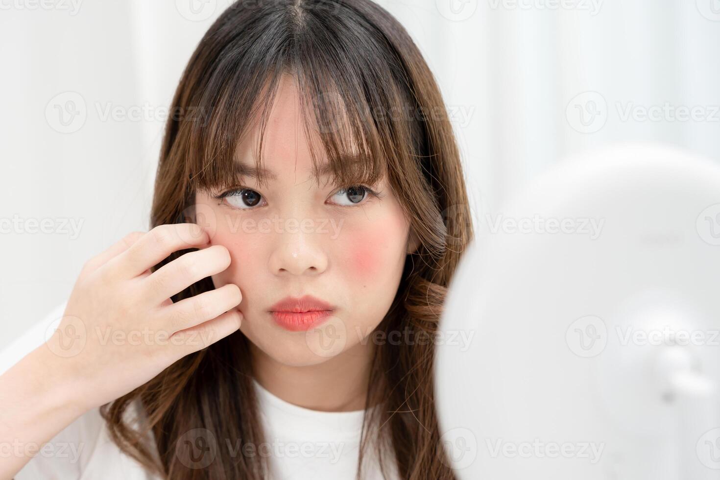 Woman worried about face Dermatology, rosacea dermatitis, allergic steroids, sensitive skin, red face from sunburn, acne, dry skin, large pores ,rash face, dull, freckles, wrinkle photo