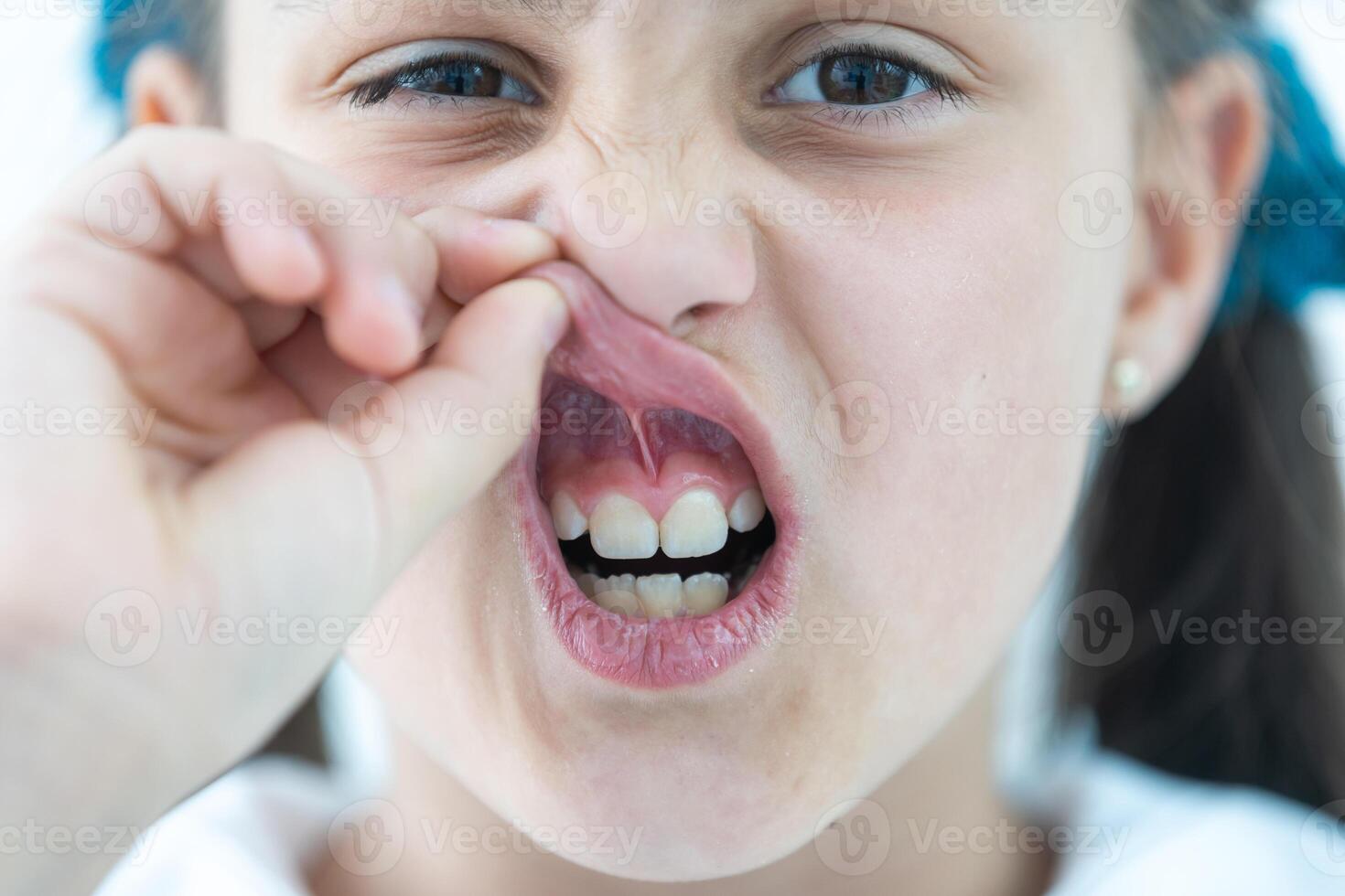 little girl showing her healthy teeth at dental office, smiling and waiting for a checkup. Early prevention, paedodontics and no fear concept. photo