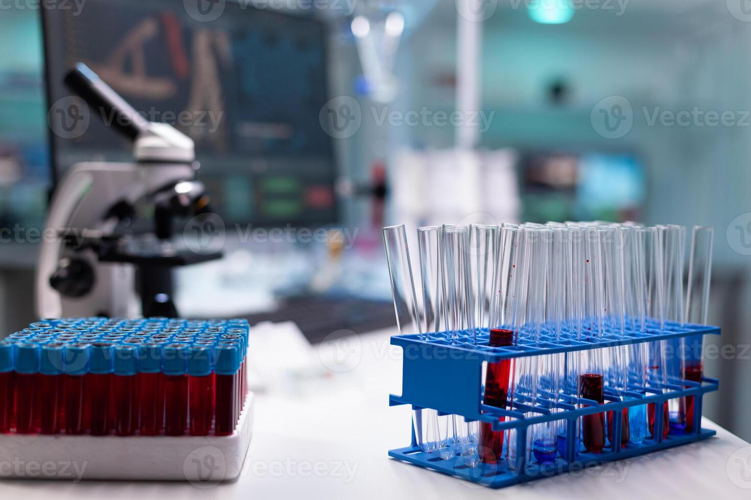 Vacutainers and test tubes on tray in science laboratory. Transparent flasks with substance, blood, liquid on desk for professional examination and analysis at chemical research clinic. photo