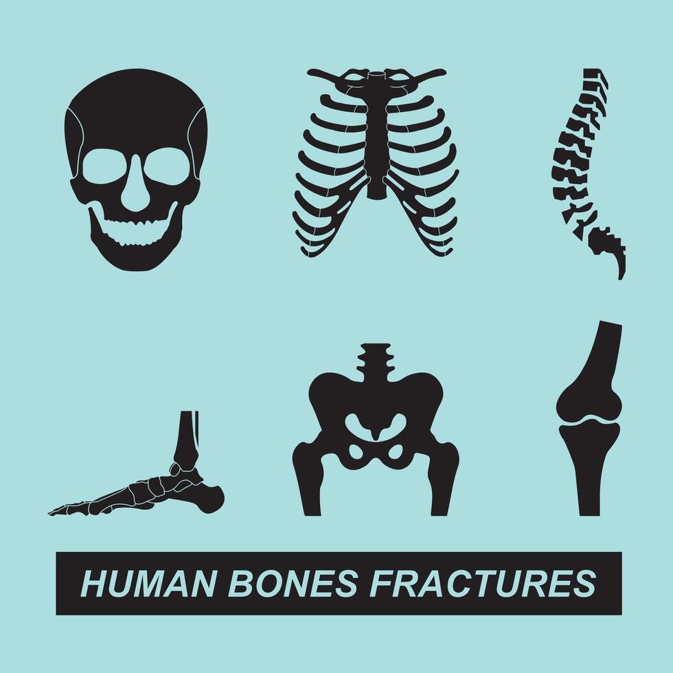 Human bones fractures icon vector