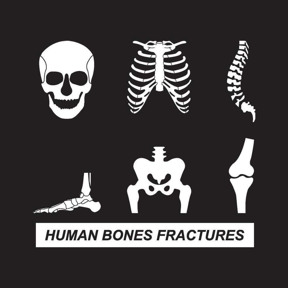 Human bones fractures icon vector