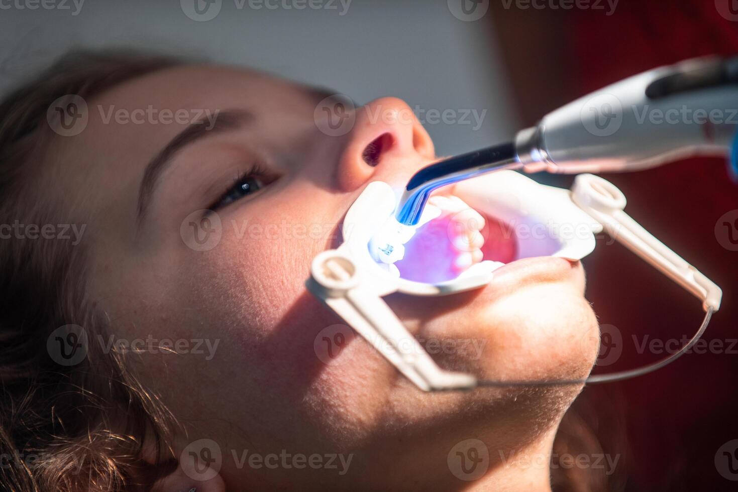 The dentist uses an ultraviolet lamp while fitting the girl with braces photo