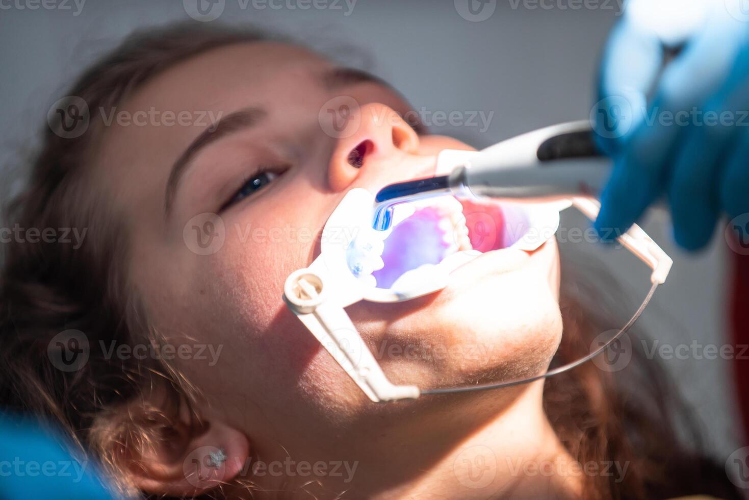 The dentist uses an ultraviolet lamp while fitting the girl with braces photo