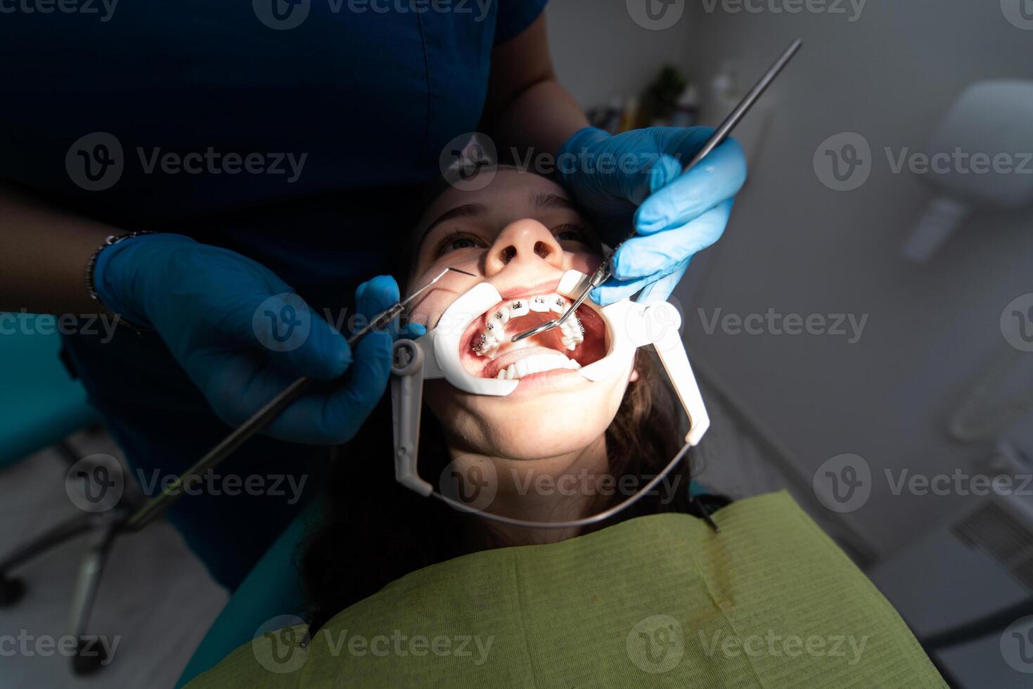 Close up of girl with brackets receiving dental braces treatment in clinic photo