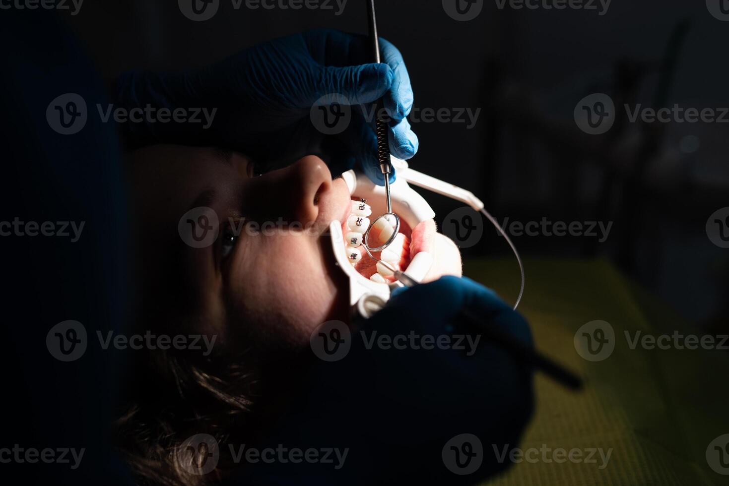 Close up of girl with brackets receiving dental braces treatment in clinic photo