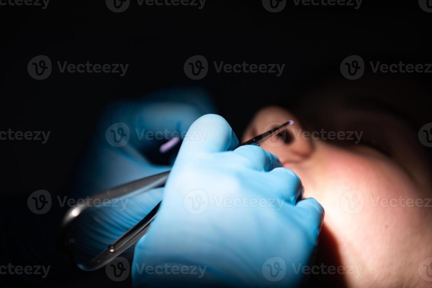 Close up of girl with brackets receiving dental braces treatment in clinic photo