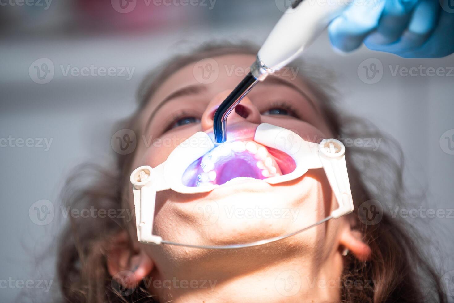 The dentist uses an ultraviolet lamp while fitting the girl with braces photo