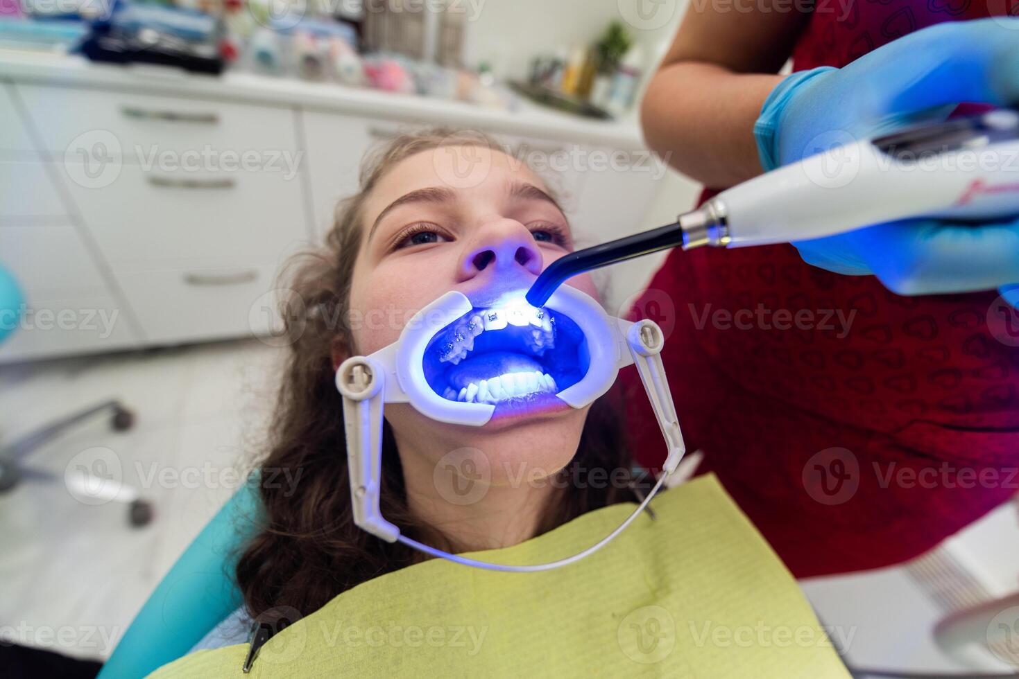 The dentist uses an ultraviolet lamp while fitting the girl with braces photo