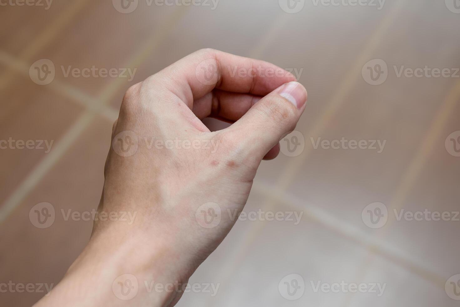 Scars on the hands caused by wounds that form dark spots show the texture of the skin of the hands in blurred background. photo