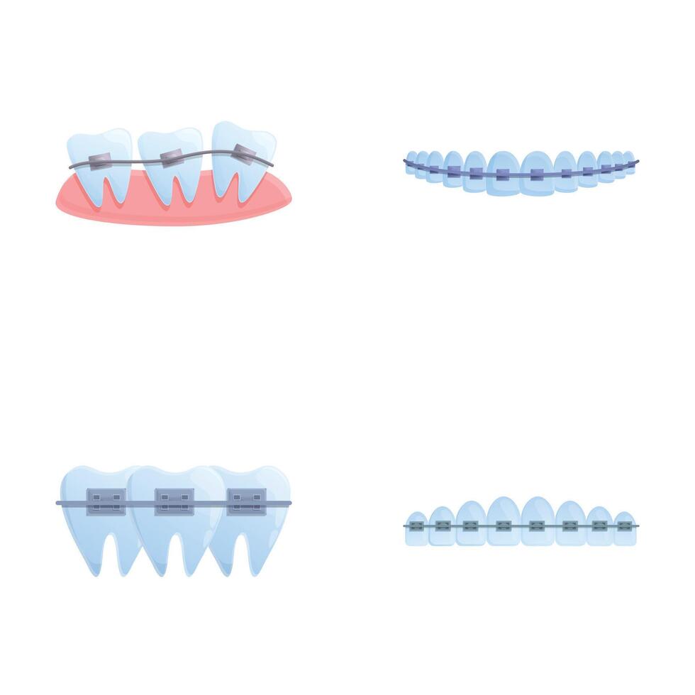 Brace system icons set cartoon . Orthodontic brace system on teeth vector