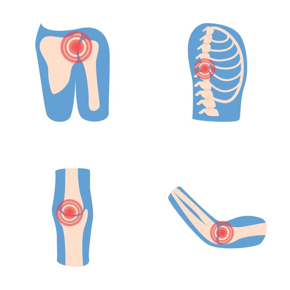 Joint inflammation icons set cartoon . Human joint with pain ring vector